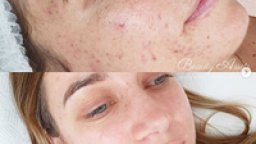 Dermavidulals